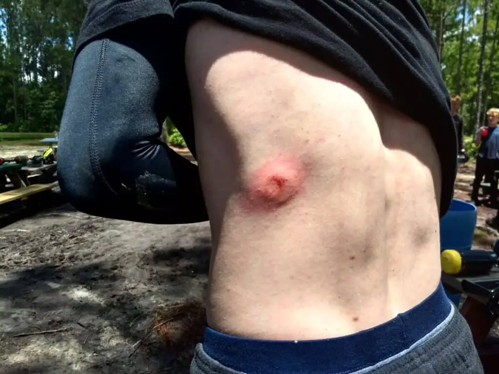 Does Paintball Hurt?